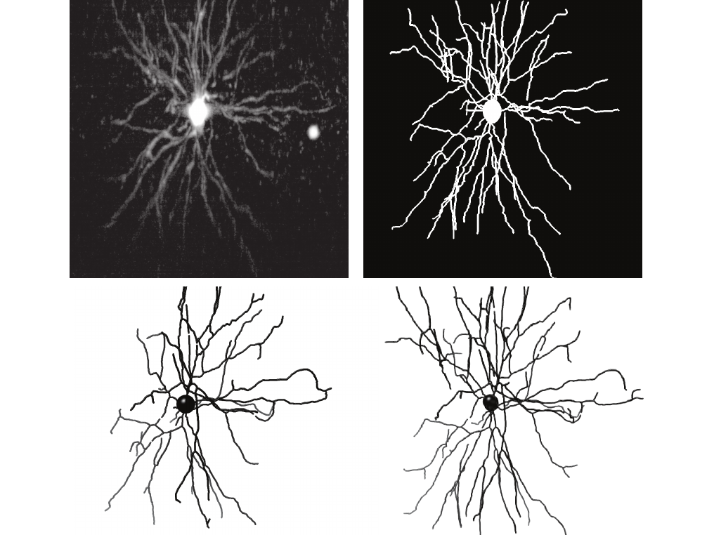 Neuronal images reconstructed using the U-Net architecture. (Upper-left) Raw image. (Upper-right) Label. (Lower-left) Reconstruction performed without augmentations or regularization. (Lower-right) Reconstruction performed with augmentations and regularization. 